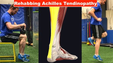 BEST Exercises For Achilles Tendon Pain (Tendinopathy Tendinitis ...