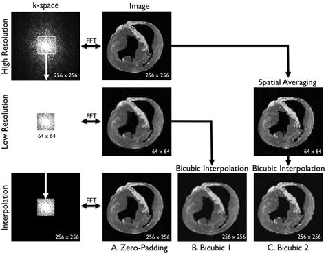 Three comparative analyses. A. Zero-padding. A fast Fourier transform ...