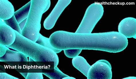 Diphtheria - Symptoms, Diagnosis, Treatment, Prevention