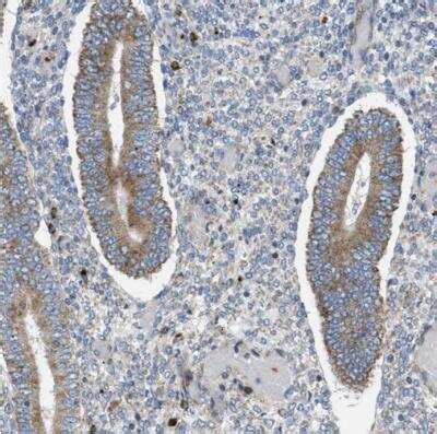 Tryptophan Hydroxylase 1/TPH-1 Antibody (NBP1-86922): Novus Biologicals