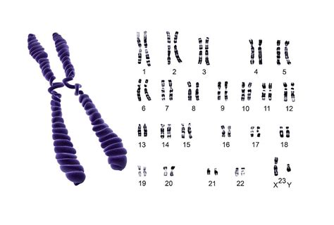 Human Male Chromosomes Photograph by Bo Veisland/science Photo Library ...