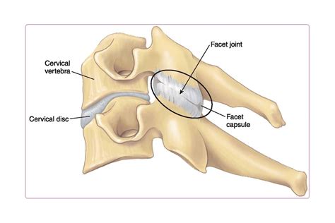 Cervical Facet Joint Anatomy | Hot Sex Picture