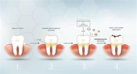 Plaque and Tartar: What they are and How to Keep them Under Control ...