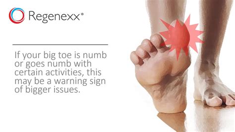 Why Is My Big Toe Numb? - Regenexx®