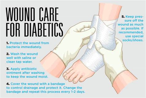 Caring for wounds and foot ulcers in diabetic patients | Sunrise Hospital