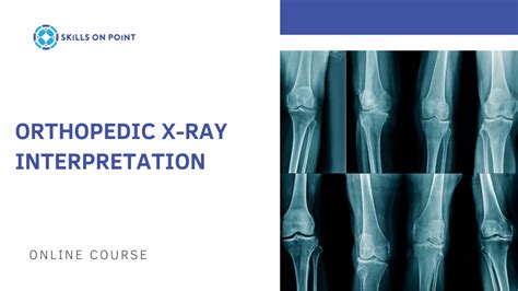 Orthopedic X-Ray Interpretation - Online Course - Skills On Point