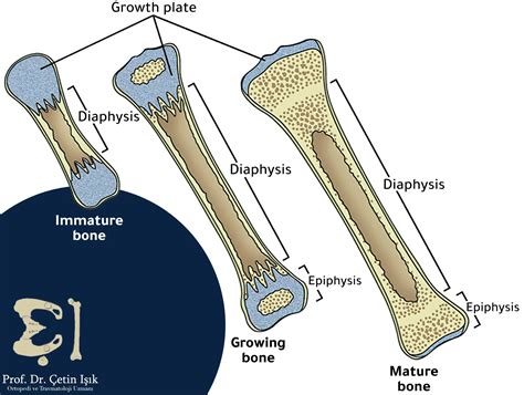 Types of bones in the human body according to several classifications ...