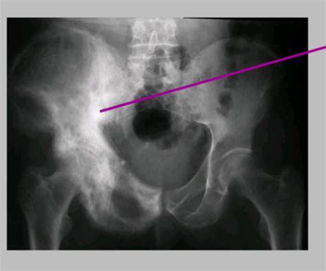 Plain Film Radiography Flashcards | Quizlet