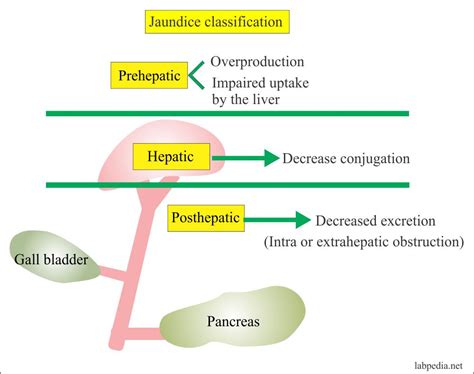 Bilirubin -Part 1- Total, Direct and Indirect Bilirubin, Classification ...