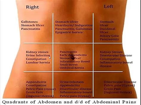 Differential Diagnosis Abdominal Pain