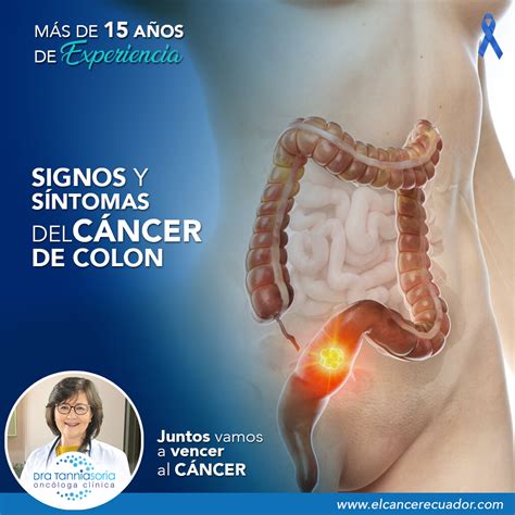 Signos y síntomas del cáncer de colon - Dra. Tannia Soria, Oncóloga ...