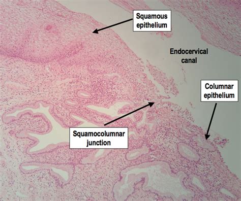 HistoQuarterly: CERVIX | Histology Blog