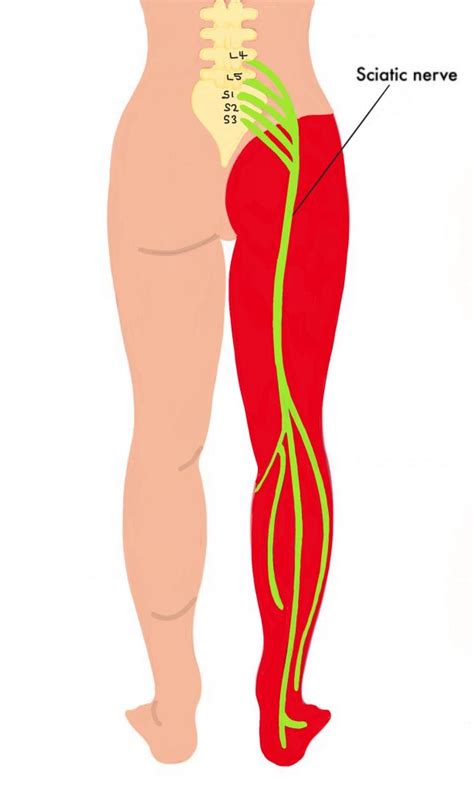 Sciatic nerve dermatome - The Iveson Clinic for Physiotherapy and ...