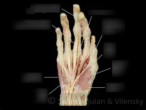 Hand Muscles Palmar Diagram | Quizlet