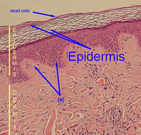 Epidermis | Definition, Anatomy and Function