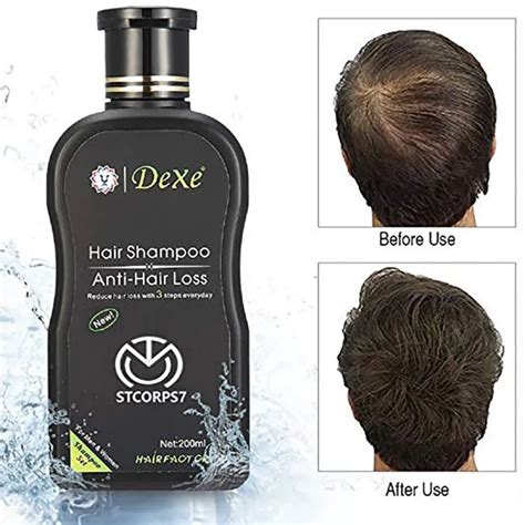 Useful Anti Hair Loss Shampoo Improve Hair Quality Natural Herbal ...