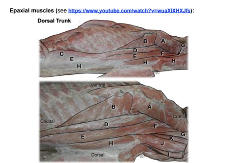 epaxial muscles dorsal trunk Diagram | Quizlet