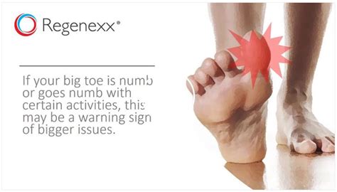 Why Is My Big Toe Numb? - Regenexx®