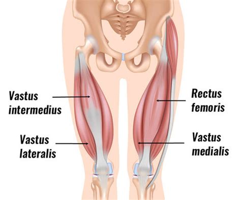 Rectus Femoris Tendon Strain - Symptoms, Causes, Treatment & Rehab