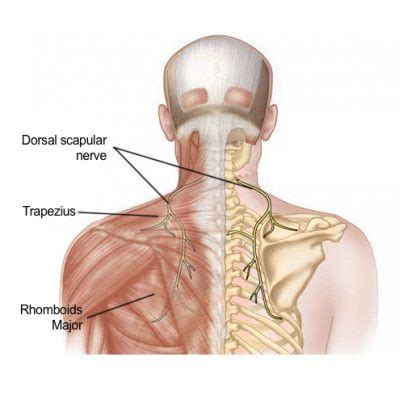 Dorsal Scapular Nerve Entrapment Syndrome - Pain Spa