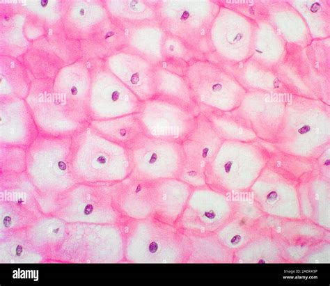 Cervical cells. Squamous epithelial cells from a human cervix ...