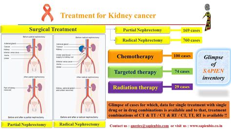 Treatment for Kidney Cancer – Sapien Biosciences