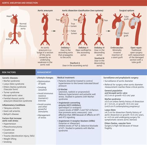 Aortic aneurysm – Artofit