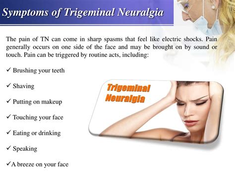 What Is Trigeminal Neuralgia And Causes Of Trigeminal Neuralgia ...