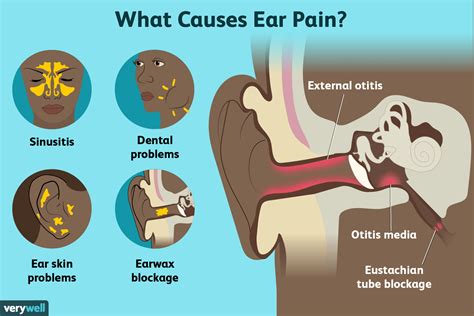 Ear Clogged Sinus Symptoms