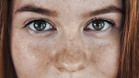 Dark Spots from Sun Damage? Here's What to Do – Be Vivid You