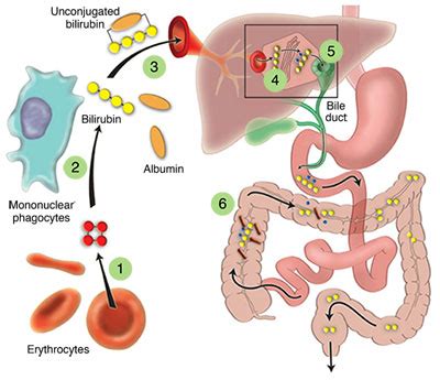 Evaluating Liver Test Abnormalities: Bilirubin Metabolism