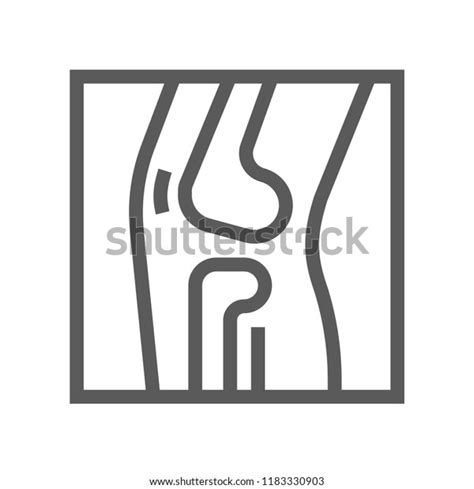 Radiography X Ray Orthopedic Trauma Rehabilitation Stock Vector (Royalty Free) 1183330903 ...