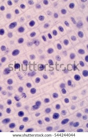 Interphase Plant Cell Microscope - mitosis1.jpg (600×308) | Mitosis ...