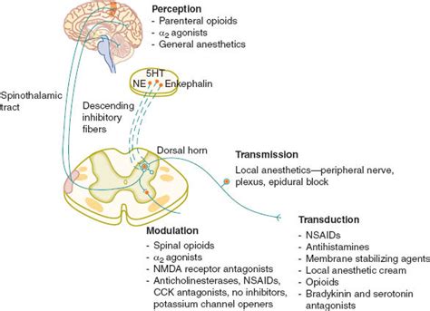 Management of Acute and Chronic Pain | Anesthesia Key