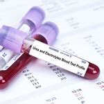 Urea and Electrolytes Blood Test Profile | Blood Tests in London