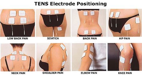 71 best T.E.N.S - Pad Placement images on Pinterest | Health, Physical ...