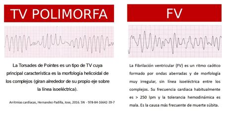 Cardio Primaria Ferrol On Twitter Repasamos Las Diferencias Entre