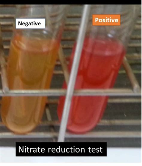 Nitrate/Nitrite Reduction Test: Principle, Requirements, Test Procedure