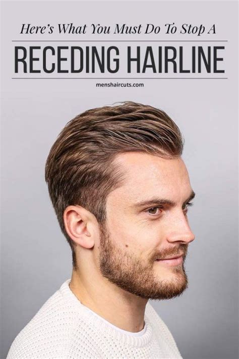 Receding Hairline Treatment Guidelines: Prevent, Resolve And Improve