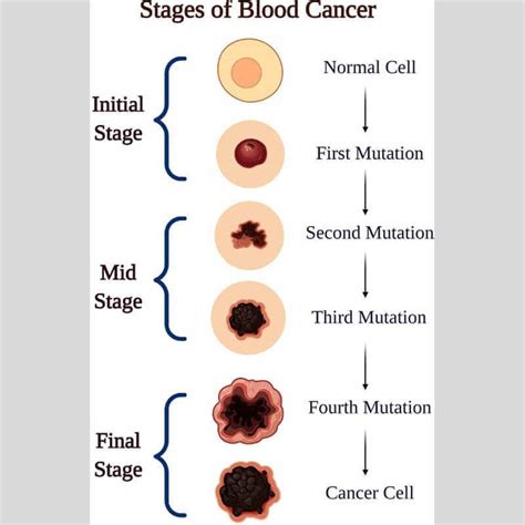 Unveiling the Mystery: Understanding Blood Cancer and Its Types | by ...