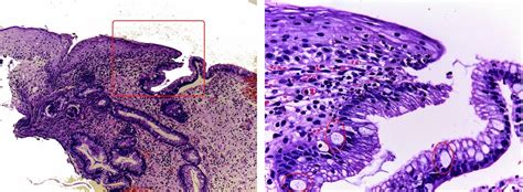 GASTROINTESTINAL AND LIVER HISTOLOGY PATHOLOGY ATLAS: ESOPHAGUS ...