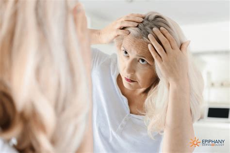 What is Frontal Fibrosing Alopecia? 6 Things You Should Know About This ...