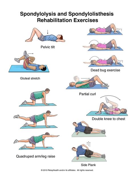 56 Best of Lumbar Spondylolisthesis Exercises - insectza