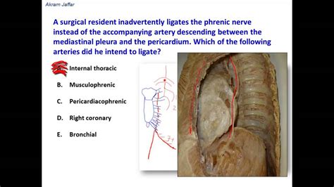 Phrenic Nerve Anatomy - Anatomical Charts & Posters