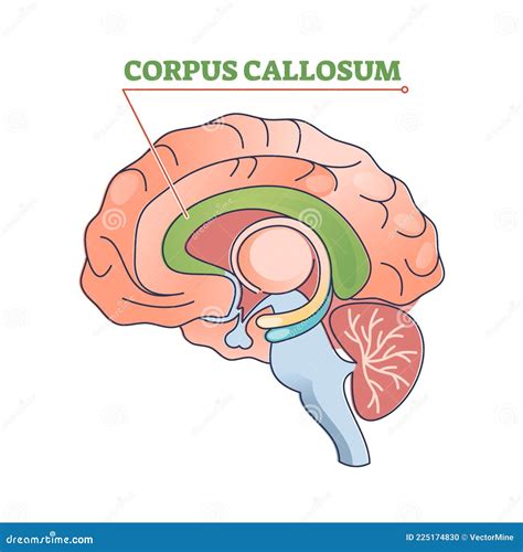 Corpus Callosum Diagram