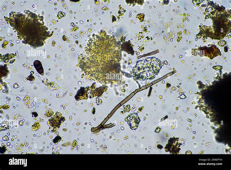 Fungal and fungi hyphae under the microscope in the soil and compost ...