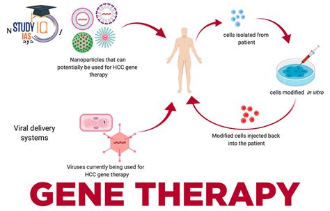 Gene Therapy