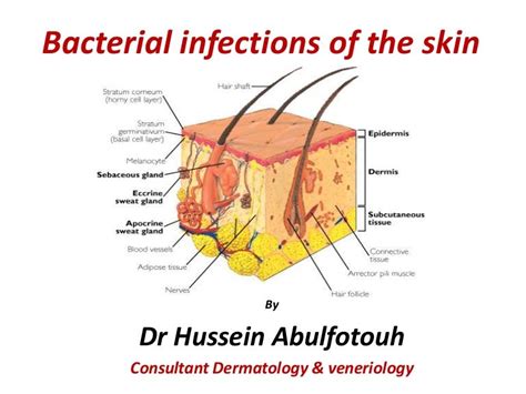 Bacterial infection of the skin