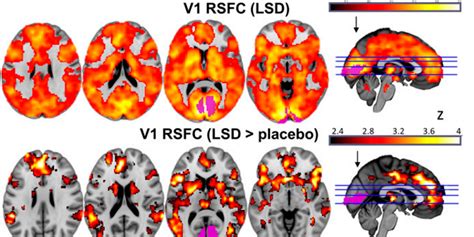 New Brain Images Show How LSD Affects Our Minds | Inverse