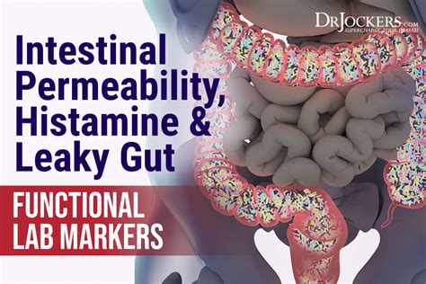 Intestinal Permeability, Histamine, and Leaky Gut Functional Lab Markers